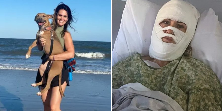 Conmoción en Estados Unidos: una mujer sufrió quemaduras severas tras una agresión química en la vía pública